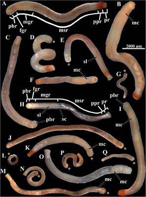 Better Alone Than in Bad Company: New Species of Caudofoveate Limifossorid (Mollusca, Aplacophora) Unravels Patterns of Distribution Hidden in the Deep Atlantic